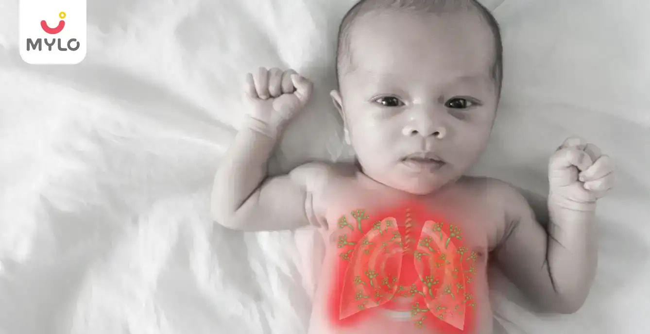 মেকোনিয়াম অ্যাসপিরেশন সিন্ড্রোম: লক্ষণ, কারণ ও চিকিৎসা