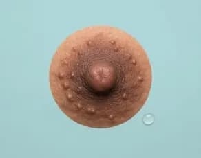 Darkening areolas with Montgomery tubercles
