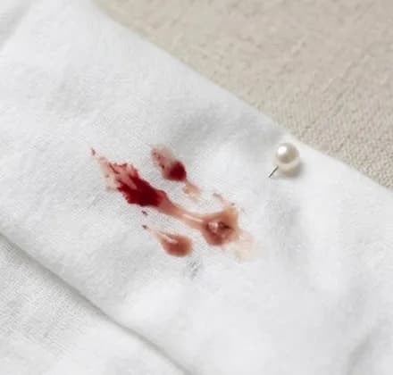 Bloody show
