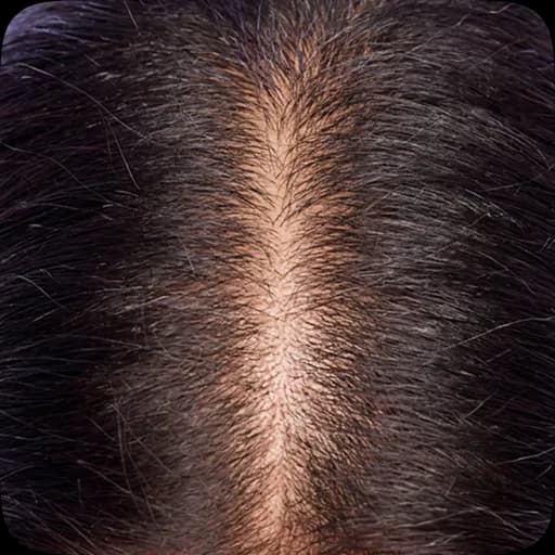 Scalp on day 1