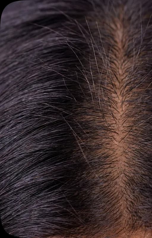 Scalp on day 28