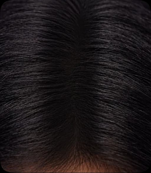 Scalp on day 84