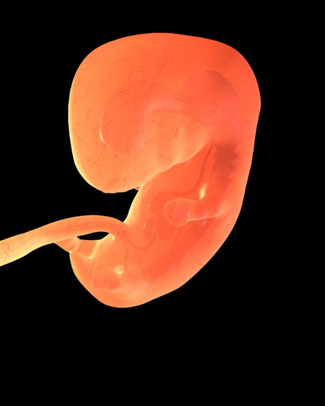 Baby at week 13