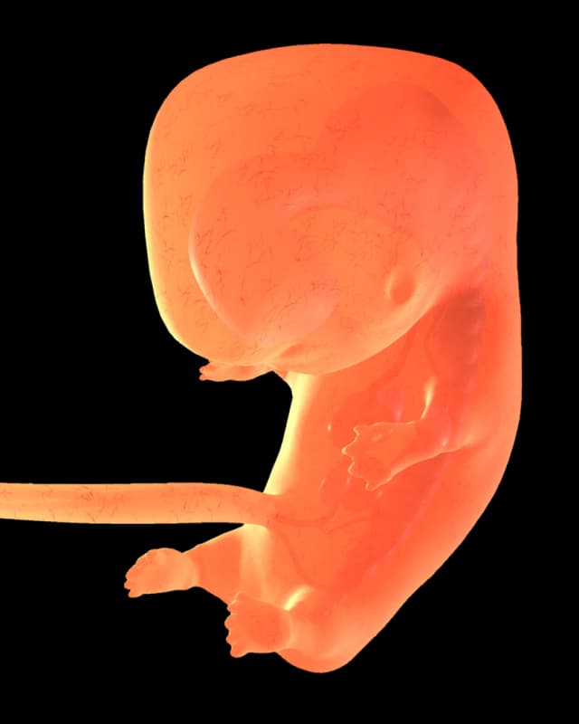 Baby at week 17