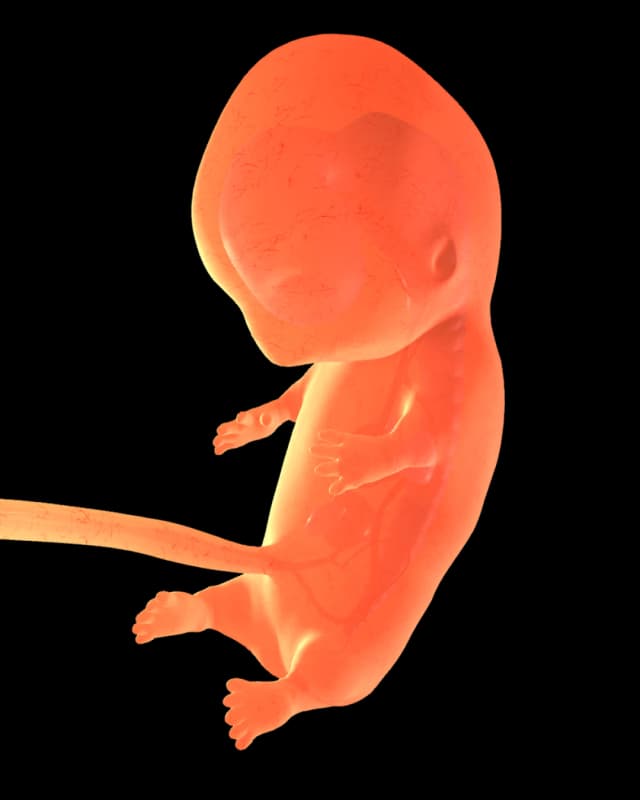 Baby at week 20