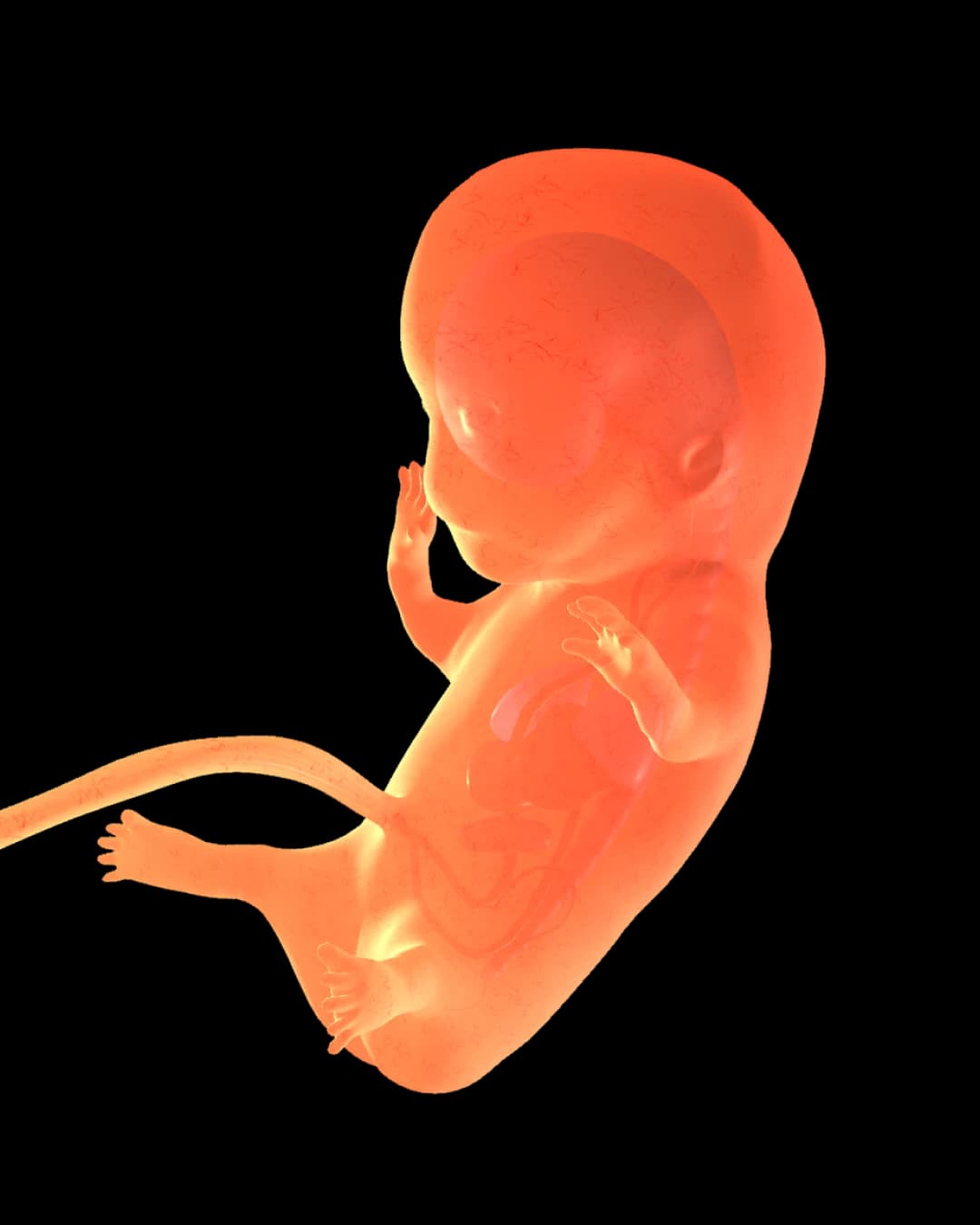 Baby at 26 weeks