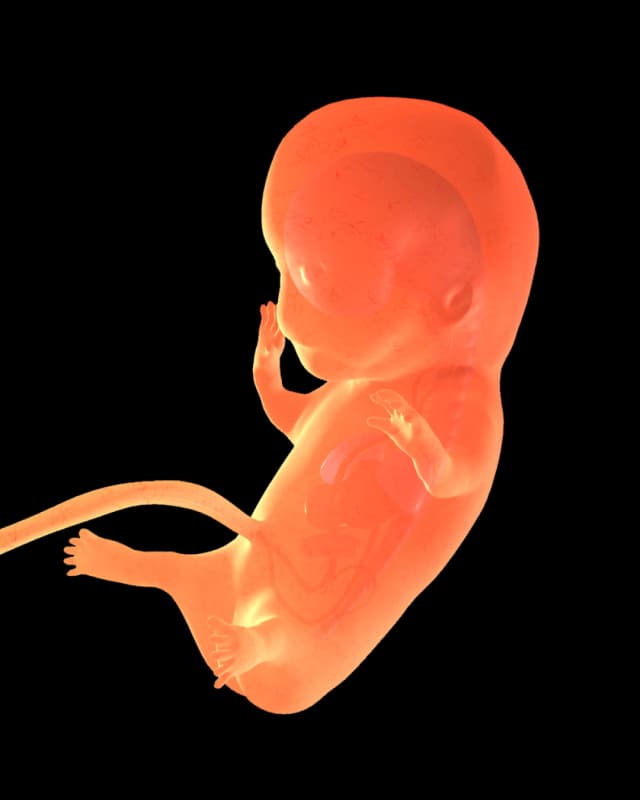 Baby at week 26