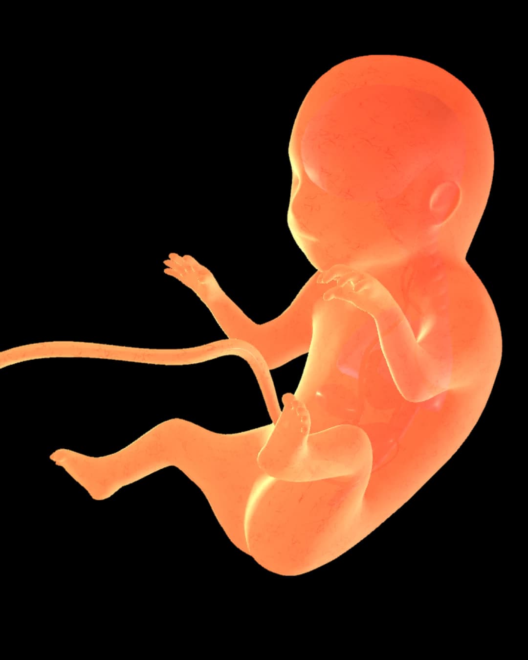 Baby at 34 weeks