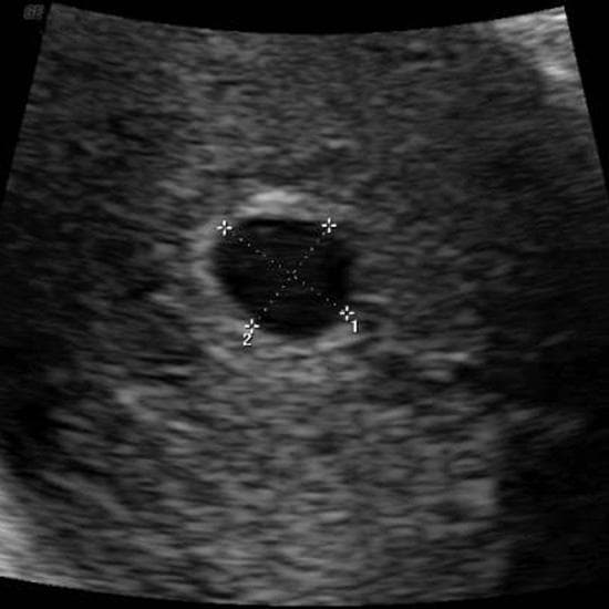 Your Ultrasound in Week 4