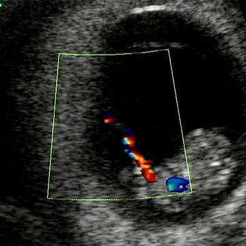 Your Ultrasound in Week 9