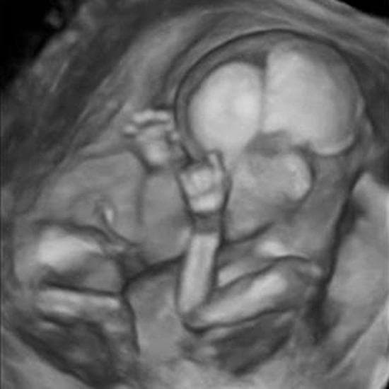 Your Ultrasound in Week 15