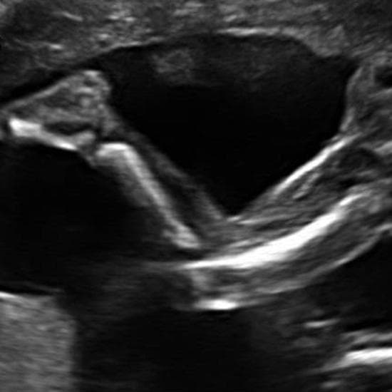 Your Ultrasound in Week 19