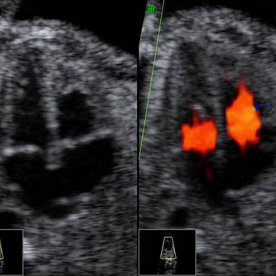 Your Ultrasound in Week 23
