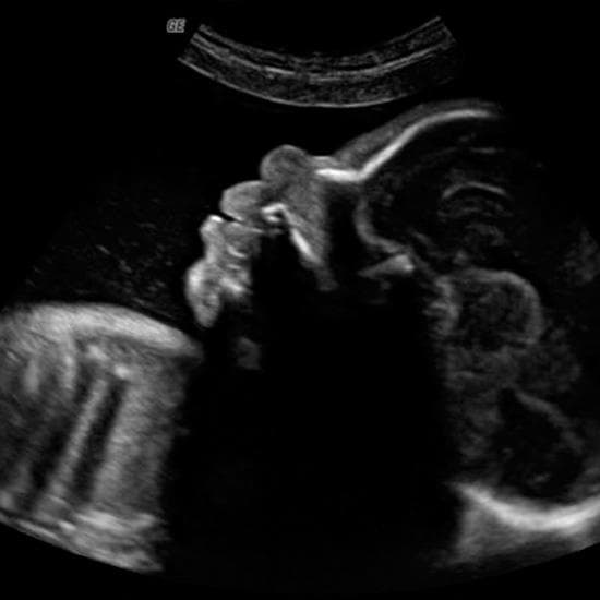 Your Ultrasound in Week 29