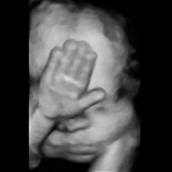 Your Ultrasound in Week 30