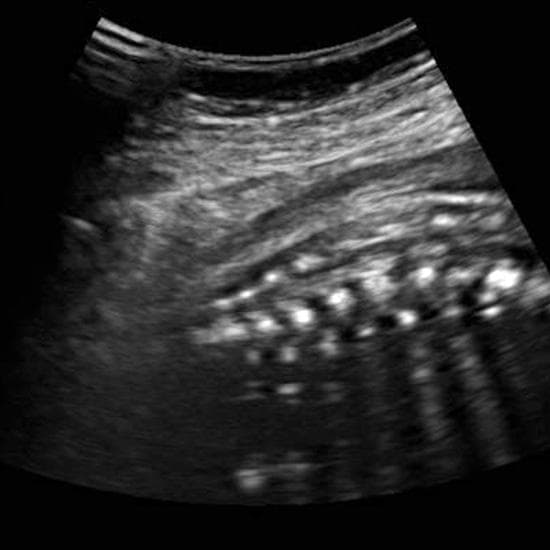 Your Ultrasound in Week 31