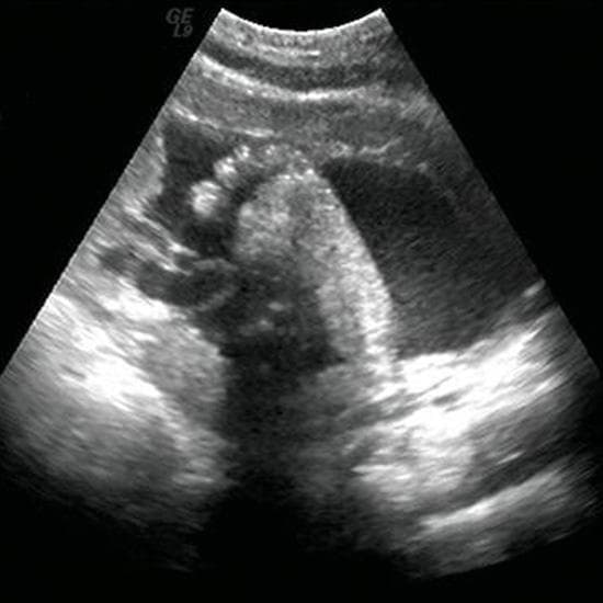 Your Ultrasound in Week 32