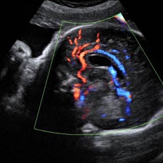 Your Ultrasound in Week 34
