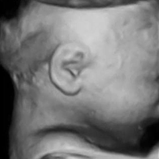 Your Ultrasound in Week 35