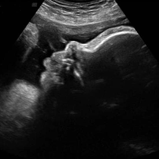 Your Ultrasound in Week 36