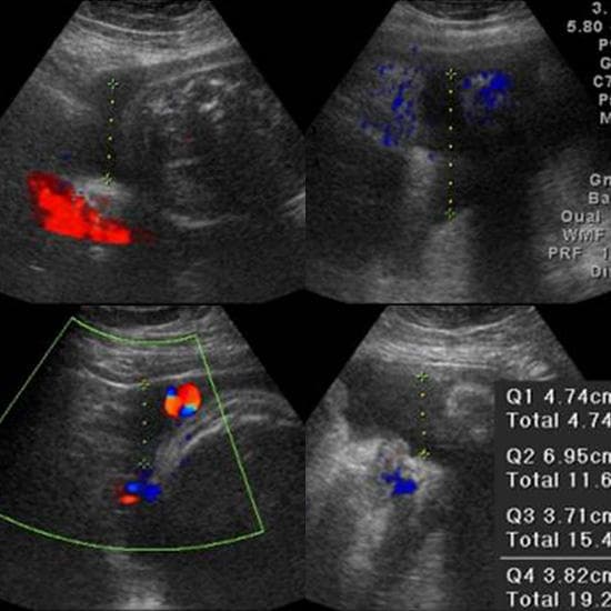 Your Ultrasound in Week 37