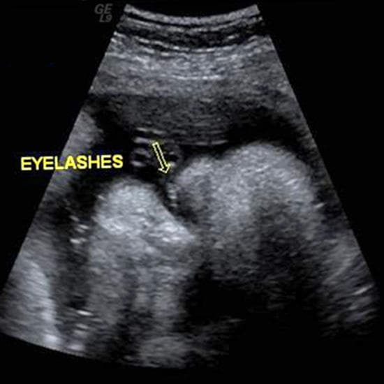 Your Ultrasound in Week 39