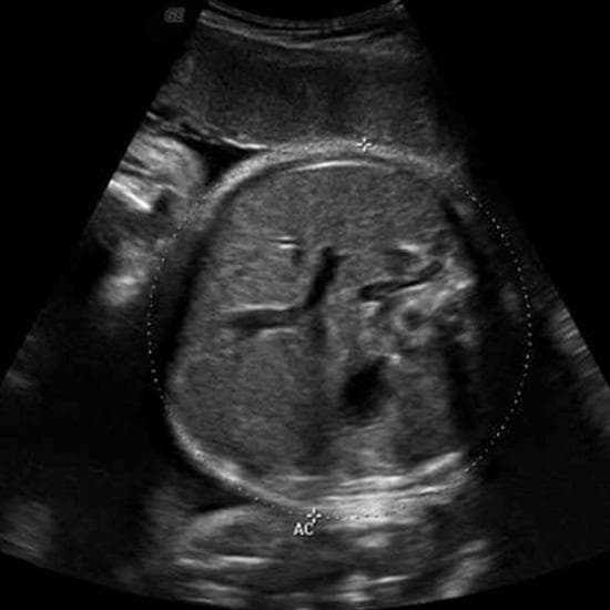 Your Ultrasound in Week 40