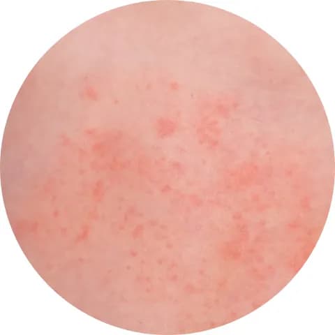 Soothes rashes and nourishes skin