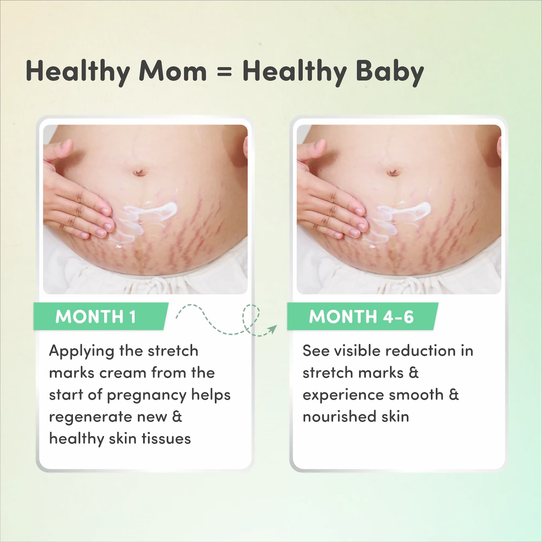 Pregnancy Wellness Super Saver Combo - Stretch Marks Cream for Women (100g) & Saffron for Pregnant Women (1g)