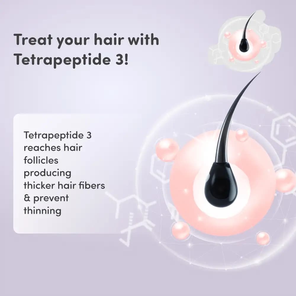 Onion Hair Shampoo - Prevents Hairfall | Keeps Scalp Healthy | Repairs Damaged Hair | Boosts Blood Circulation | Nourishes Hair (200 ml)
