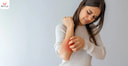 Images related to Symptoms of Eczema in Hindi | एक्जिमा क्यों होता है? जानें इसके कारण और लक्षण