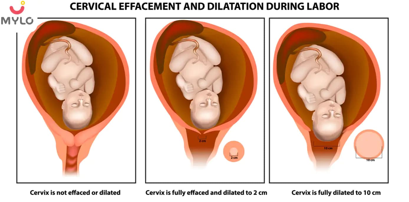 Baby Crowning During Birth: What is it and How Does it Feel?