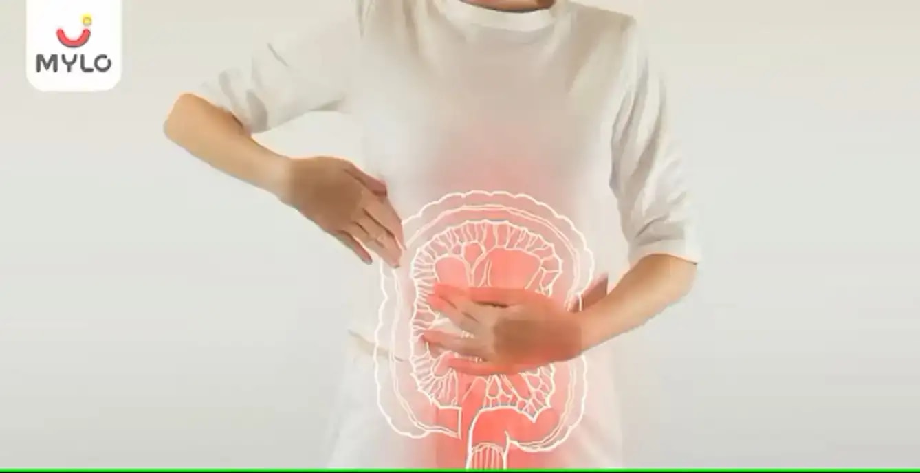 குடல் எரிச்சல் சிண்ட்ரோம் - அர்த்தம், காரணங்கள், வகைகள் மற்றும் சிகிச்சைகள்