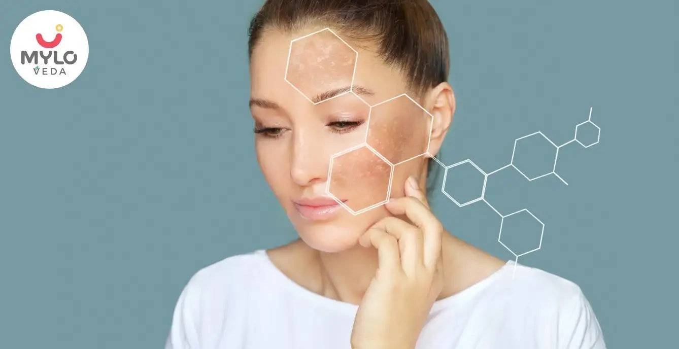 টি ট্রি অয়েল এর সাহায্যে ত্বকের ত্রুটিগুলি চিকিৎসা করার জন্য 5টি সেরা পদ্ধতি