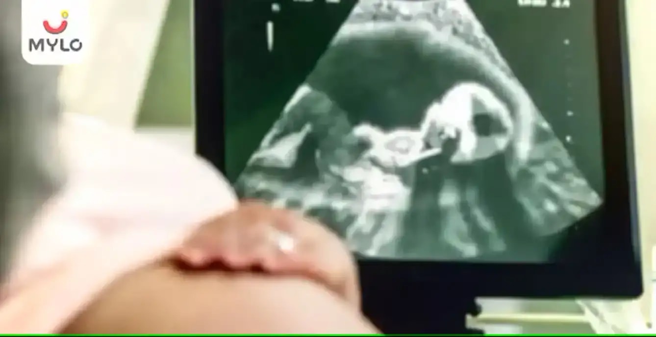 ஆக்கிரமிப்பு இல்லாத பிரசவத்திற்கு முந்தைய அனைத்து சோதனைகளைப் பற்றியும் நீங்கள் தெரிந்து கொள்ள வேண்டும்