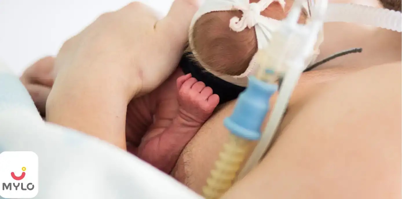 Images related to প্রিম্যাচিউর শিশুদের ক্ষেত্রে ক্যাঙ্গারু কেয়ারের উপকারিতা (What are the Benefits of Kangaroo Care for Premature Babies in Bengali)