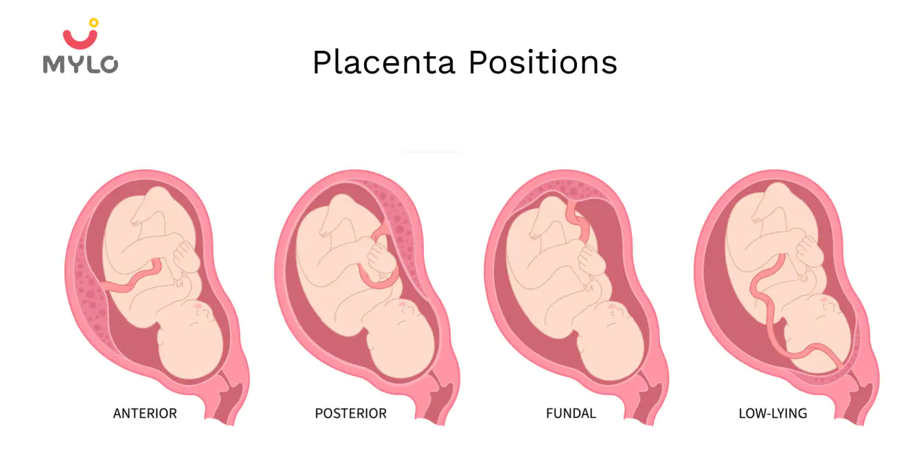 Placenta Position: How It Affects Your Pregnancy and Delivery