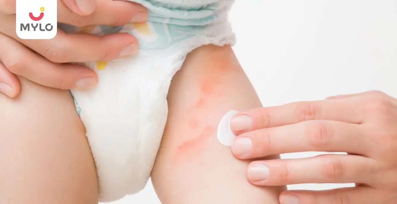 பல்வேறு வகையான டயபர் ரேஷ்களை எவ்வாறு தெரிந்து கொள்வது மற்றும் சிகிச்சையளிப்பது.