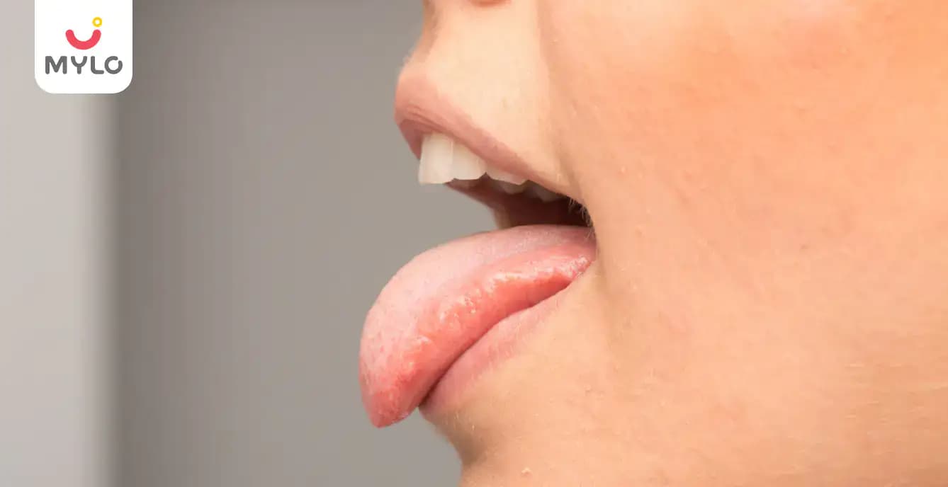 Saliva During Pregnancy: Causes & Prevention