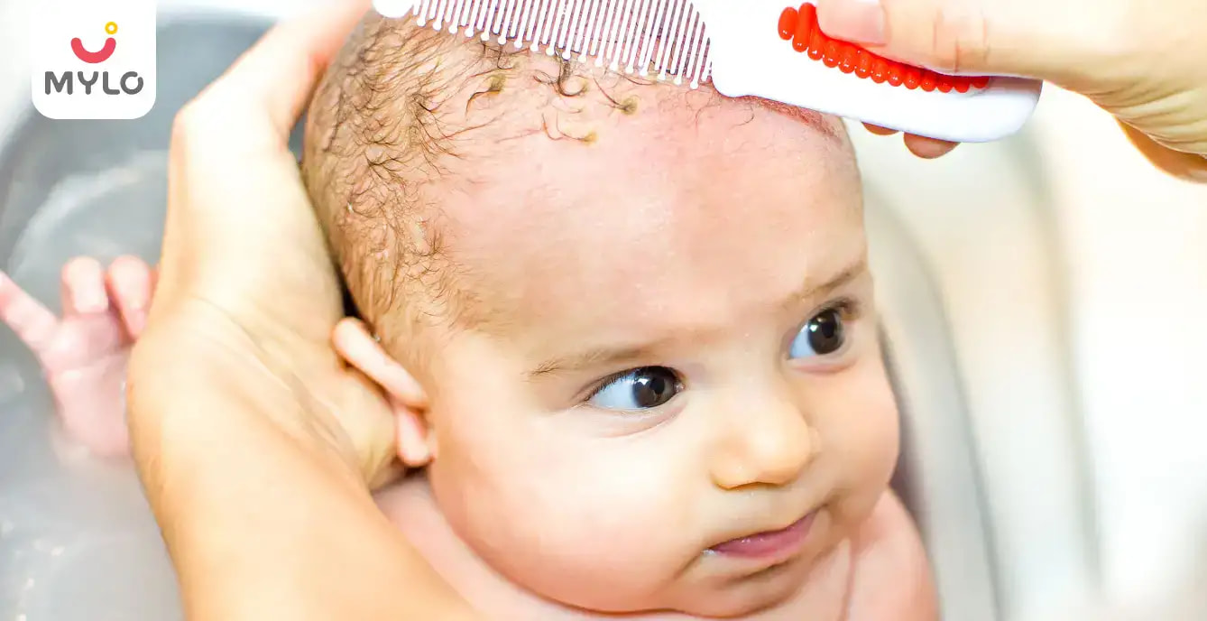 Cradle Cap: Causes, Symptoms & Treatment in Infants