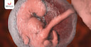 Images related to 4 వారాల ప్రెగ్నెన్సీ తర్వాత బేబీ సైజ్ ఎలా ఉంటుంది? (Size of Baby After 4 Week Pregnancy in Telugu?)