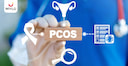 Images related to PCOS Tests: The Power of Diagnostic Tests in Your Health Journey