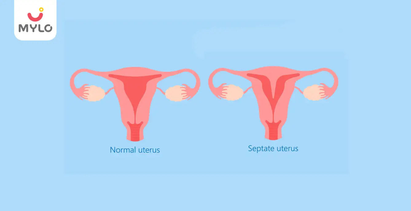 Septate Uterus: A Comprehensive Guide on Symptoms, Risks, and Treatment Options