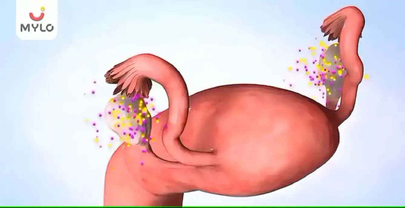 கர்ப்ப காலத்தில் கார்பஸ் லியூடியம்: செயல்பாடுகள், உருவாக்கம் மற்றும் கோளாறுகள்