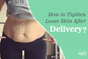 Images related to 5 Effective Ways To Tighten Loose Skin Post Delivery