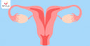 Images related to Bicornuate Uterus: A Comprehensive Guide on Causes, Symptoms and Treatment Options
