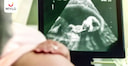 Images related to Noninvasive Prenatal Testing in Hindi | प्रेग्नेंसी में क्यों होता है NIPT टेस्ट?