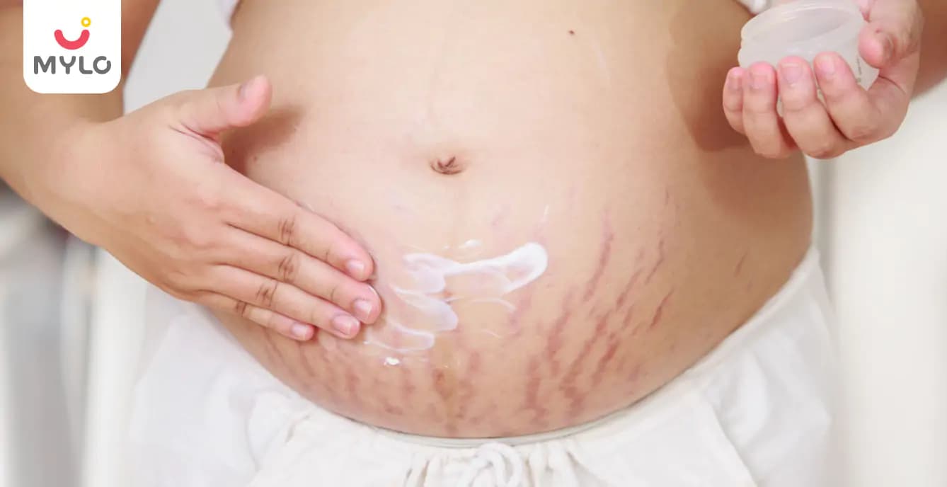 How to Get Rid of Red Stretch Marks that occur during pregnancy?