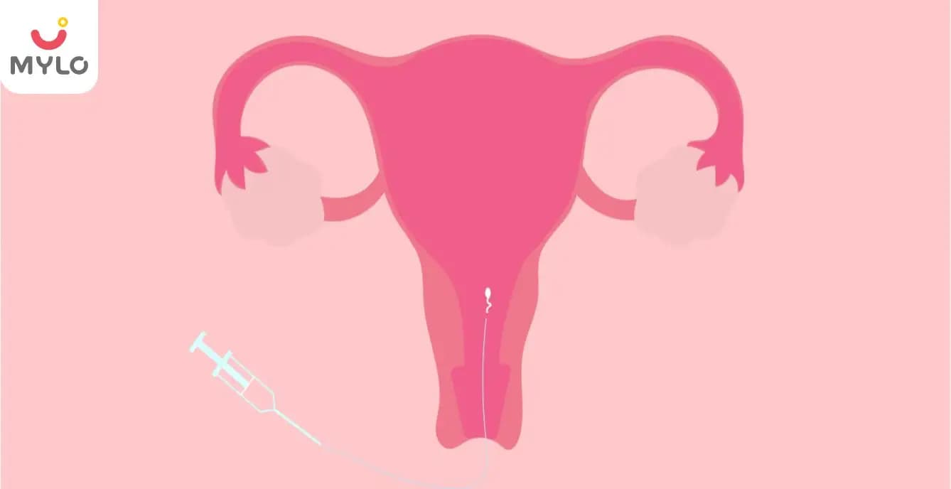 Is IUI (Intra Uterine Insemination) Painful?