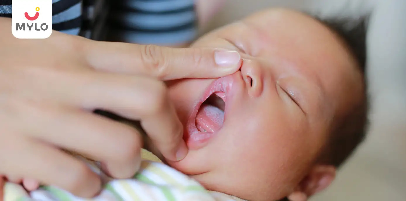 Baby Mouth Ulcer in Hindi | बेबी के मुँह में भी आते हैं छाले! जानें इसके कारण
